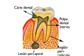 Tratamento de Canal (Endodontia)